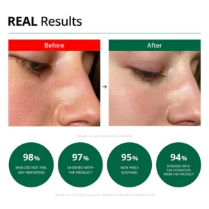 Dr. G Red Blemish Clear Soothing Cream korean skincare